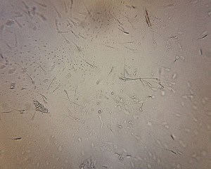 microscope image of live boar semen