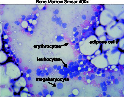 Bone marrow 400x