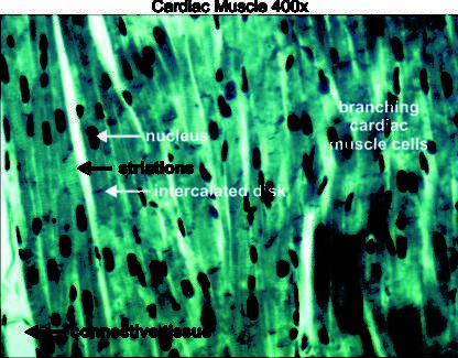 Cardiac muscle 400x