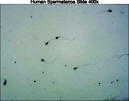 Human spermatozoa 400x