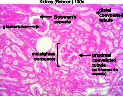 Kidney 100x