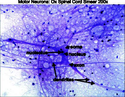 Motor neurons 200x