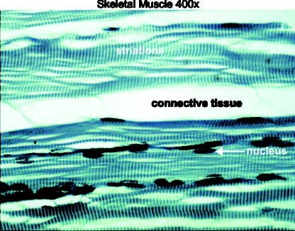 Skeletal muscle 400x