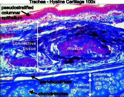 Trachea hyaline cartilage 100x