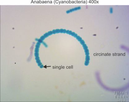 Anabaena 400x