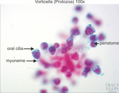 Vorticella 100x